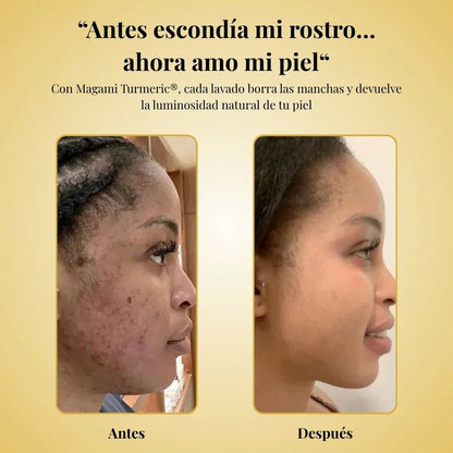 ✨ DESPIGMENTANTE avanzado Magami Turmeric® + ENVÍO GRATIS